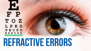 What are Refractive Errors?