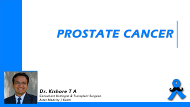 Prostrate Cancer & Treatment Options