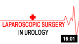 Laparoscopic Surgery in Urology
